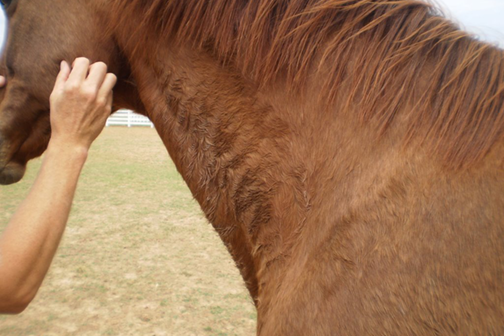 Clinical sign hypertrichosis